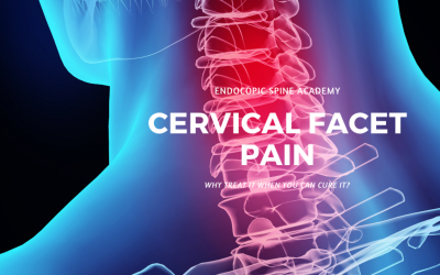 Why Manage Cervical Facet Pain When You Can Cure it?