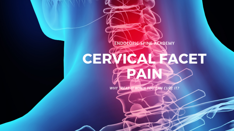 Why Manage Cervical Facet Pain When You Can Cure it?